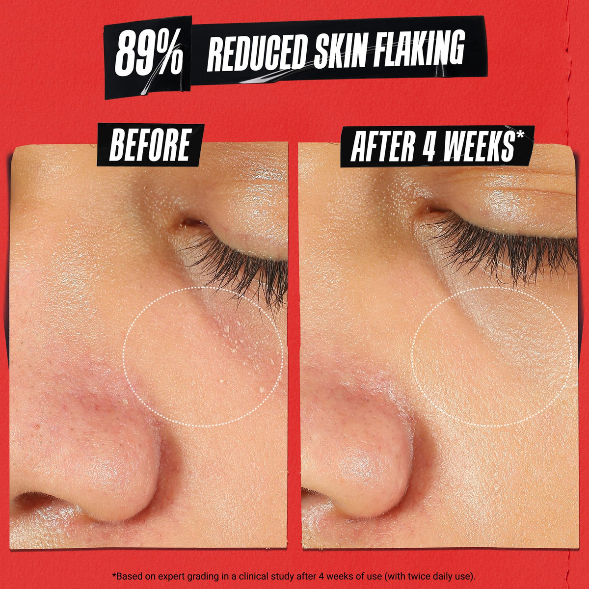 Tan Kiehl's - Ultra Facial Meltdown Recovery Barrier Cream, 1% Colloidal