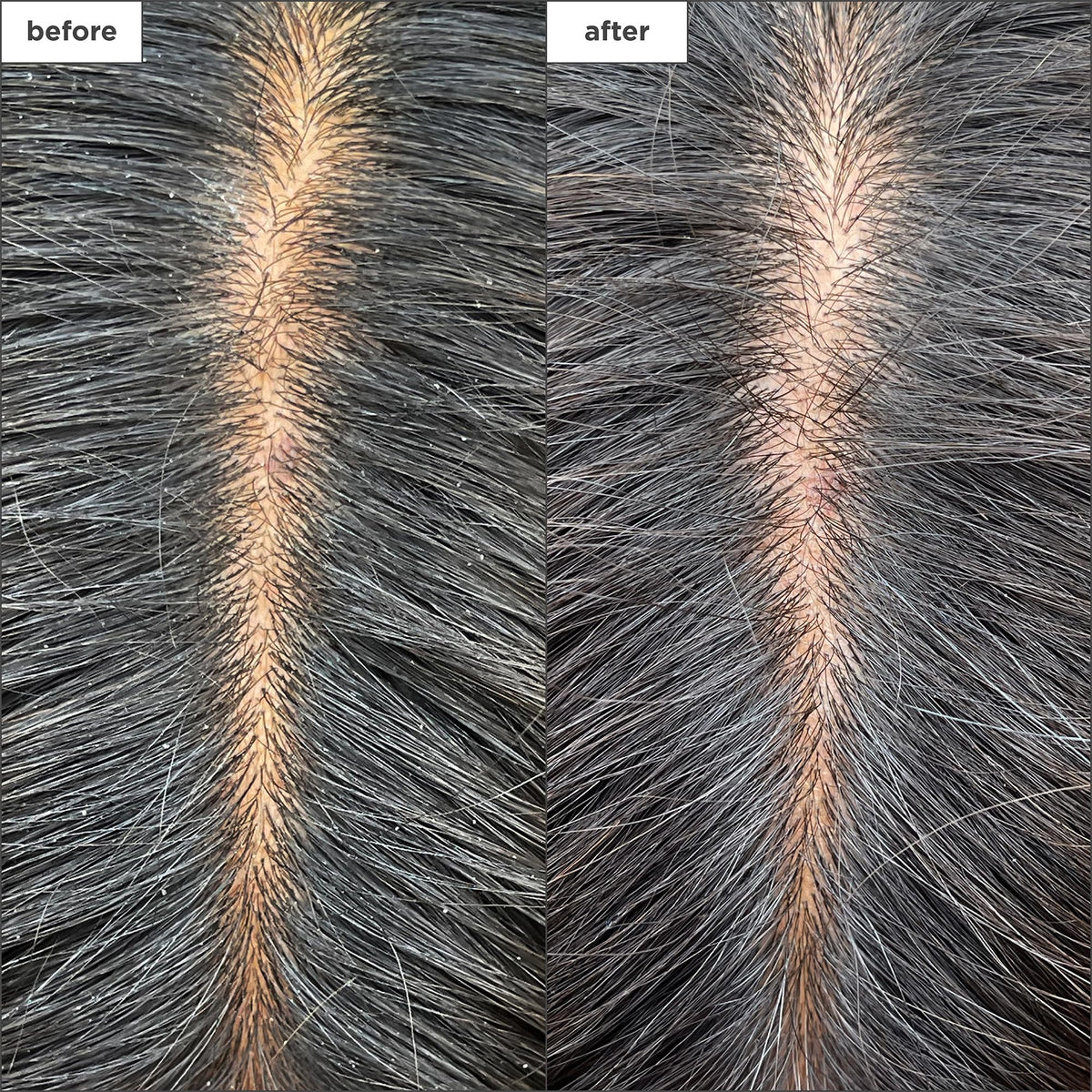 Dim Gray Briogeo Scalp Revival Charcoal + Tea Tree Cooling Hydration Scalp Mask