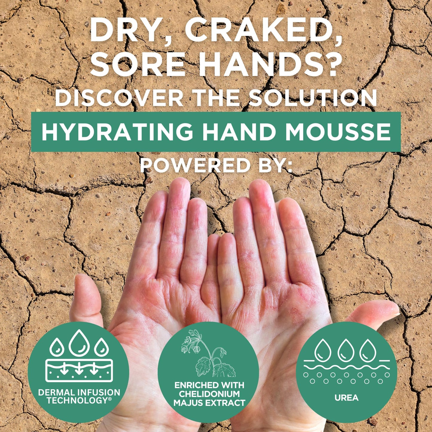Tan Footlogix Hydrating Hand Mousse with Dermal Infusion Technology® | Deep Hydration for Dry Hands | Urea-Enriched Formula | Fast-Absorbing | 4.23 ozl/119.9 g/125 ml